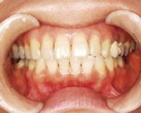 楽に顎を動かせるようになりました