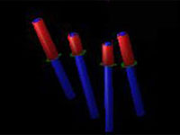 赤い部分がインプラント