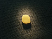 ラミネートベニア(被せ物)