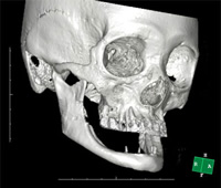下アゴがおかしいと全身のバランスを崩してしまう