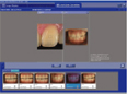 歯牙撮影条件同様の色補正を実現・撮影歯牙以外の歯列色情報を入手可能